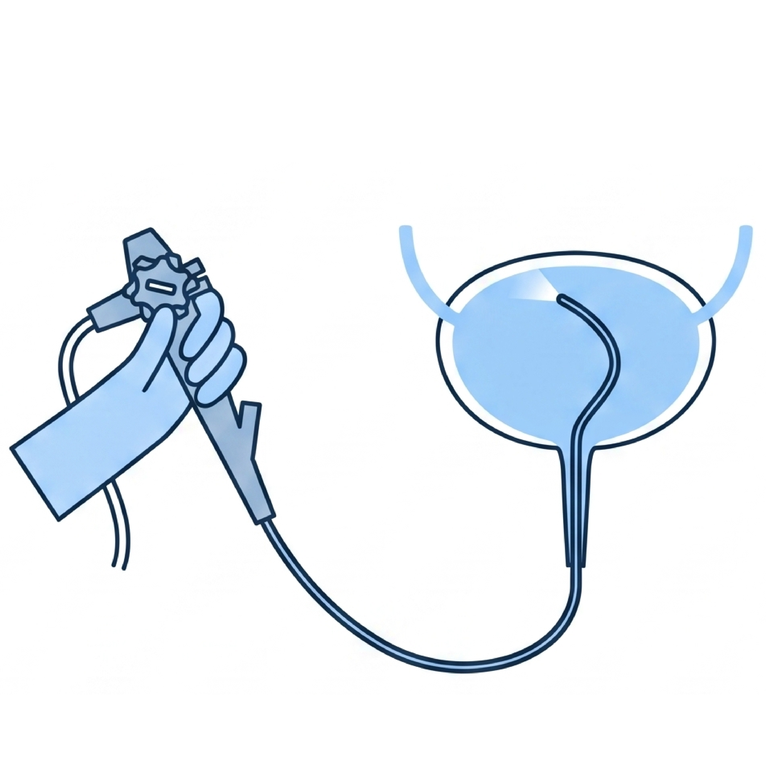 Ícone – Cistoscopia