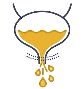 Ícone – Tratamento de Incontinência Urinária Feminina
