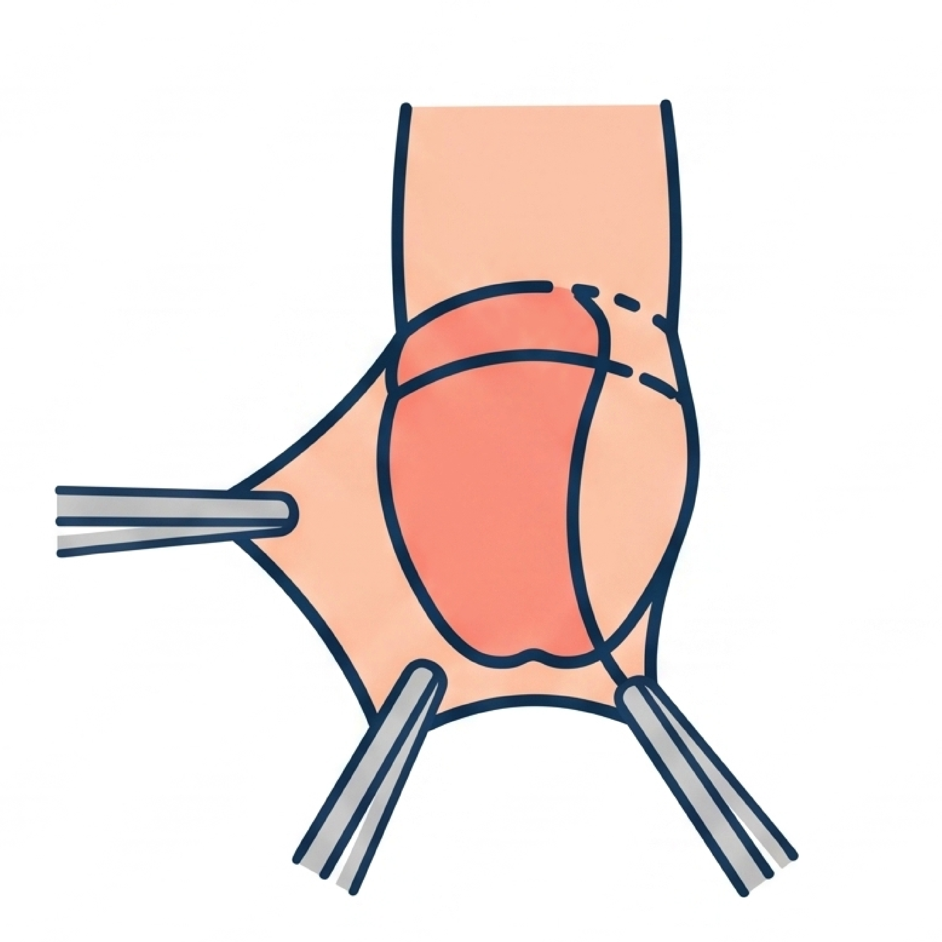Ícone – Postectomia (Circuncisão)